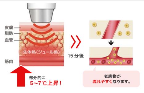 キャビエスト CAVIEST キャビテーション+ラジオ波 複合痩身機器