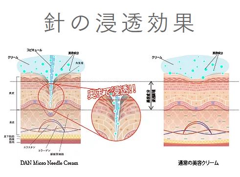 幹細胞美容クリーム オールインワン ”DANマイクロニードルクリーム” 保湿 弾力 ハリ 美白