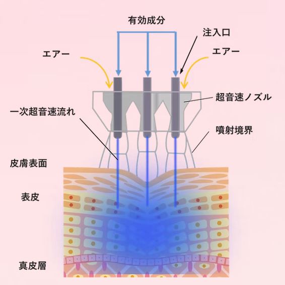 エアバリフト ニードルレスエアインジェクションスキンスクライバー フェイシャル