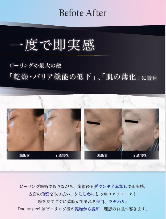 ダクトピール（Dactor-Peel) 韓国技術特許 Youth P-SOL DactorTec 80%配合 濃度